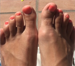 A client on holiday with a gel polish pedi