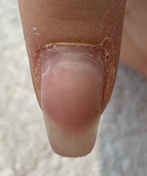 This nail has pocket lifting, which is only visible as a small strip at the base of the nail. The nail tech did not file down any previous lifting & infilled another techs work.