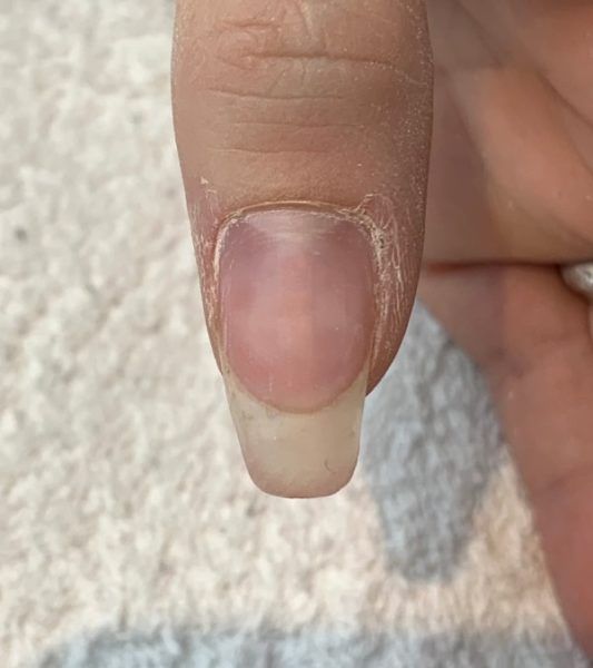 The lifting all removed.