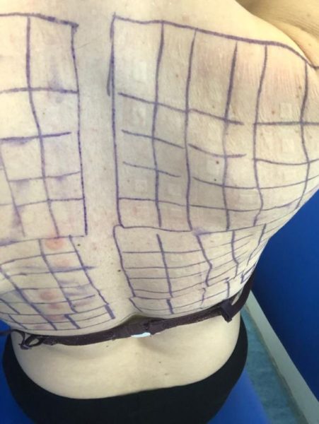 Patch testing in progress