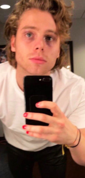 Singer, Luke Hemmings, from 5 Seconds of Summer shows off a bold red manicure.