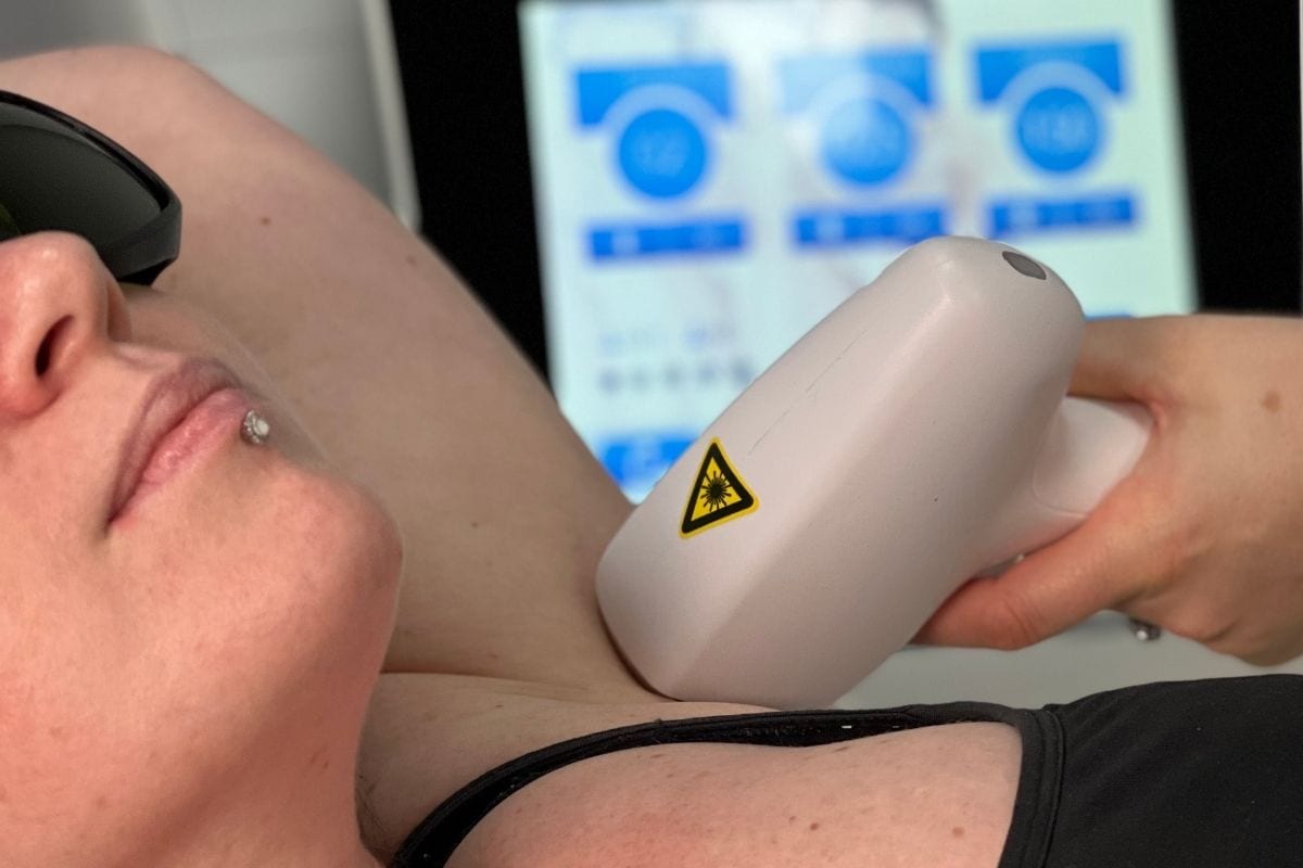 Smart Diode underarm