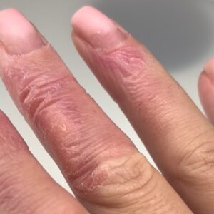 Sophie pritchard allergy