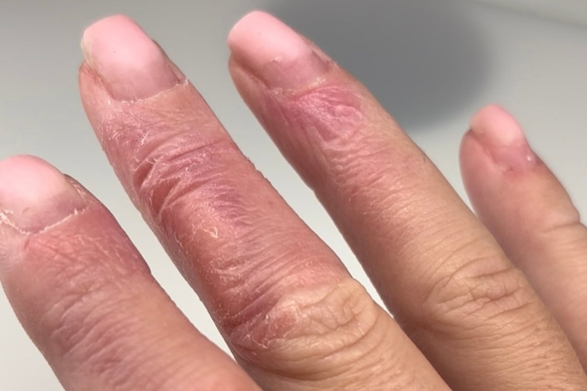 Sophie pritchard allergy