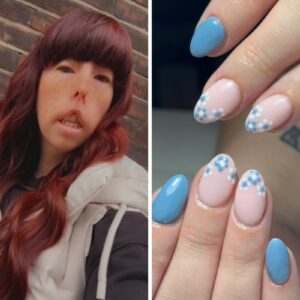 Jade fox nail tech with moebius syndrome